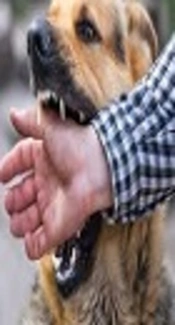 Animal Bites: Epidemiological Considerations in the East of Ahvaz County, Southwestern Iran (2011 - 2013)