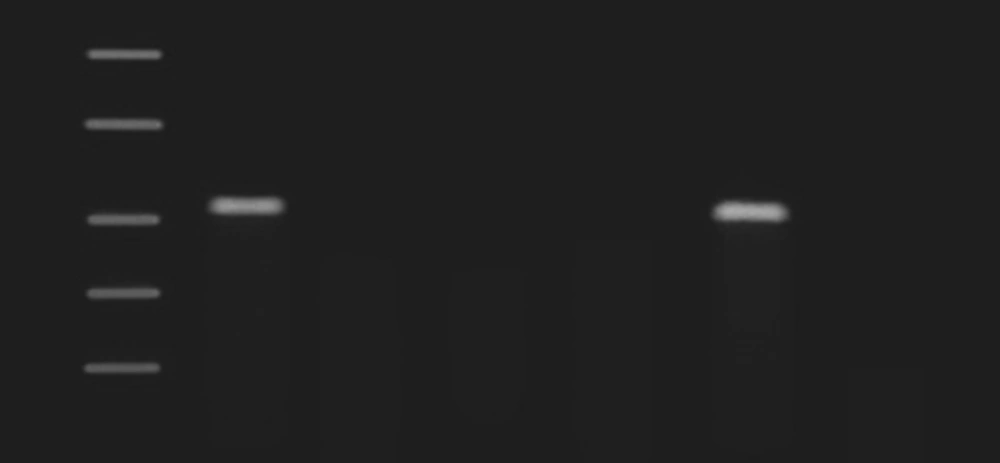 Specificity of HSV PCR M: SM1108 DNA ladder (MBI Fermentas, USA); Lane 1: herpes simplex virus (positive control); Lane 2: Hepatitis B; Lane 3: Salmonella Spp.; Lane 4: Mycobacterium tuberculosis; Lane 5; herpes simplex virus; Lane 6: negative control.