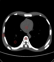 Iranian Journal of Radiology