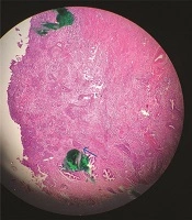 International Journal of Cancer Management