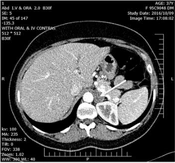 Int J Endocrinol Metab