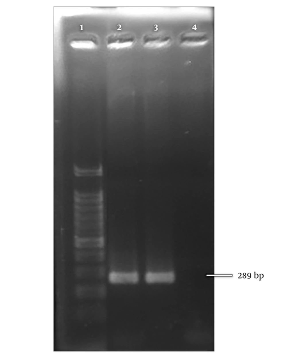 Positive control for hMPV. Lane 1; 100 bp ladder, lane 2; positive control, lane 3; positive clinical sample, lane 4; negative control. Positive control for hMPV. Lane 1; 100 bp ladder, lane 2; positive control, lane 3; positive clinical sample, lane 4; negative control.