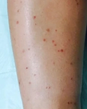 Archives of Clinical Infectious Diseases