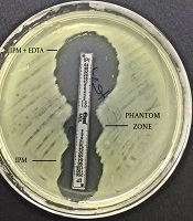 Jundishapur Journal of Microbiology 