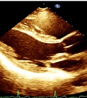 Multidiscip Cardio Annal