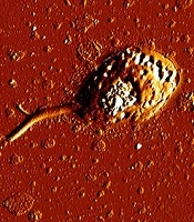 Jundishapur Journal of Microbiology