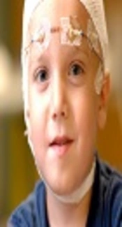 Epileptic Children, EpilepsyU