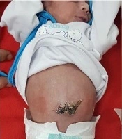 Iranian Journal of Pediatrics 