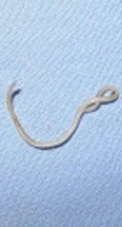 First Report of <i>Toxocara canis</i> Seroprevalence in Military Personnel and Their Families with Eosinophilia Referred to a Military Hospital in Tehran, Iran, 2015 - 2016