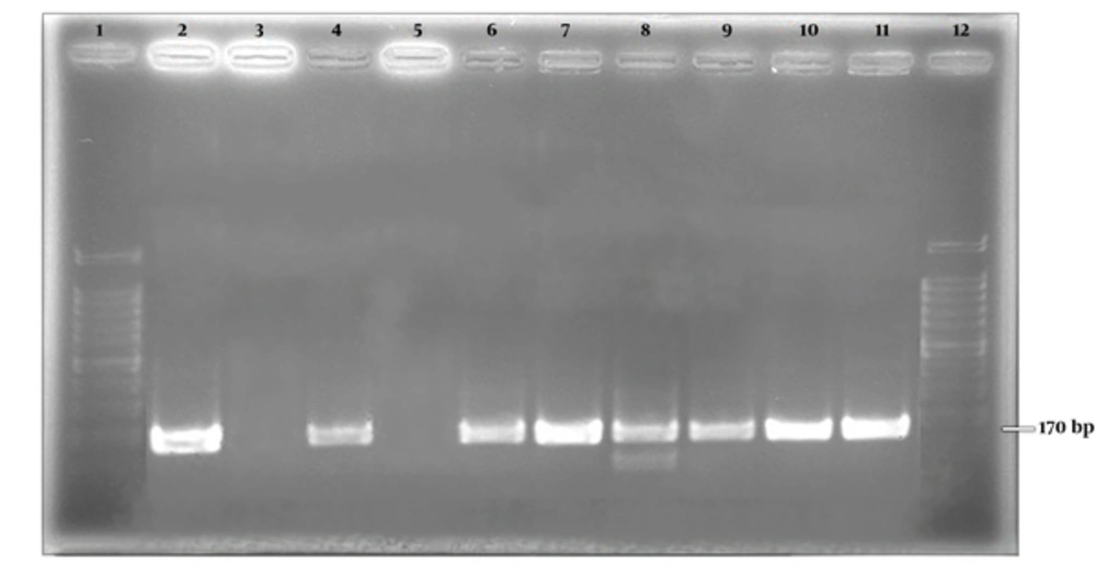 Positive control for hMPV types A and B. Lane 1 , 12; 100 bp ladder, lane 2; positive control for type A, lane 3; negative control for type A, lane 4; Positive control for type B, lane 5; Negative control for type B, lanes 6 - 11; positive clinical samples for type A. Positive control for hMPV types A and B. Lane 1 , 12; 100 bp ladder, lane 2; positive control for type A, lane 3; negative control for type A, lane 4; Positive control for type B, lane 5; Negative control for type B, lanes 6 - 11; positive clinical samples for type A.