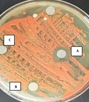 J Kermanshah Univ Med Sci