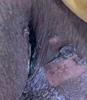 J Skin Stem Cel