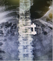 Arch Neurosci