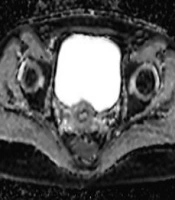 Iranian Journal of Radiology