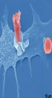 Cytomegalovirus Exposure, Medical Xpress