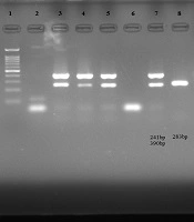 Jundishapur Journal of Microbiology 