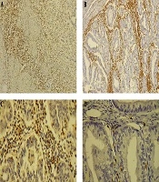 International Journal of Cancer Management