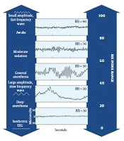 Archives of Neuroscience