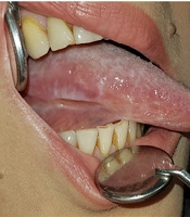 Middle East J Rehabil Health Stud