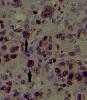 Archives of Clinical Infectious Diseases