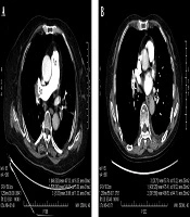 Iranian Journal of Radiology