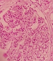 Nephro-Urology Monthly