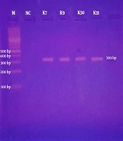Jundishapur Journal of Microbiology