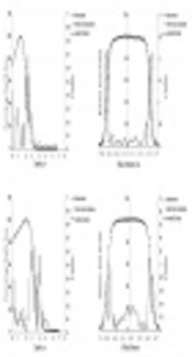 Evaluation of Putty Metal for Internal Shielding for Patient Protection in Electron Therapy by Monte Carlo Study