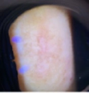 J Skin Stem Cell