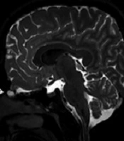 Iranian Journal of Radiology