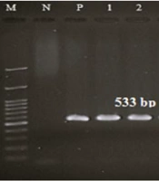 Jundishapur J Microbiol