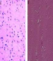 Gene, Cell and Tissue