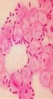 Diversity Determination of CTX-M1 Producing <i>Klebsiella pneumoniae</i> Using Multilocus Variable-Number Tandem Repeat Analysis, Semnan, Iran