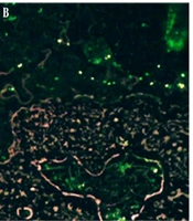 Jundishapur J Microbiol