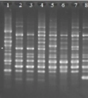 Jundishapur J Microbiol