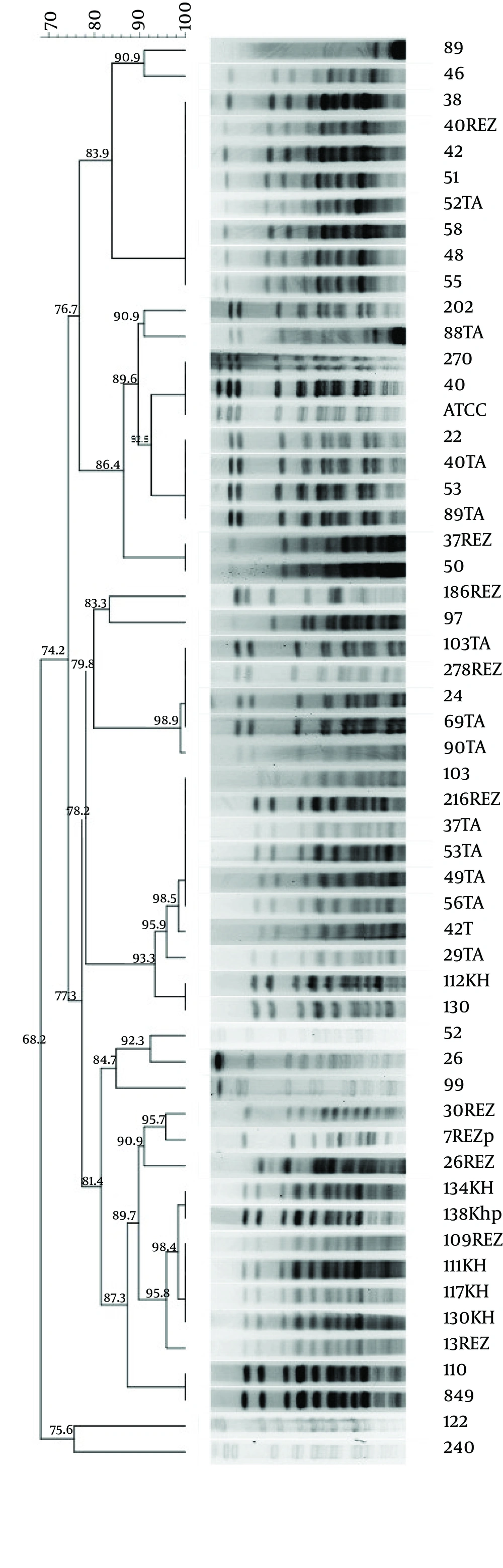 Pulsed-field gel electrophoresis dendrogram of ESBL isolates of <i>Acinetobacter</i> baumannii Pulsed-field gel electrophoresis dendrogram of ESBL isolates of <i>Acinetobacter</i> baumannii