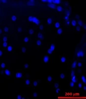 Gene Cell Tissue
