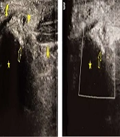 Iranian Journal of Radiology
