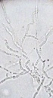 An Unusual Case of Nosocomial <i>Trichosporon asahii</i> Fungemia in a Patient with <i>Tuberculous meningitis</i>