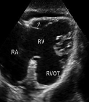 Journal of Comprehensive Pediatrics