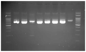 Jundishapur J Microbiol