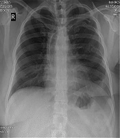 Multidisciplinary Cardiovascular Annals