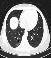 Iranian Journal of Radiology 