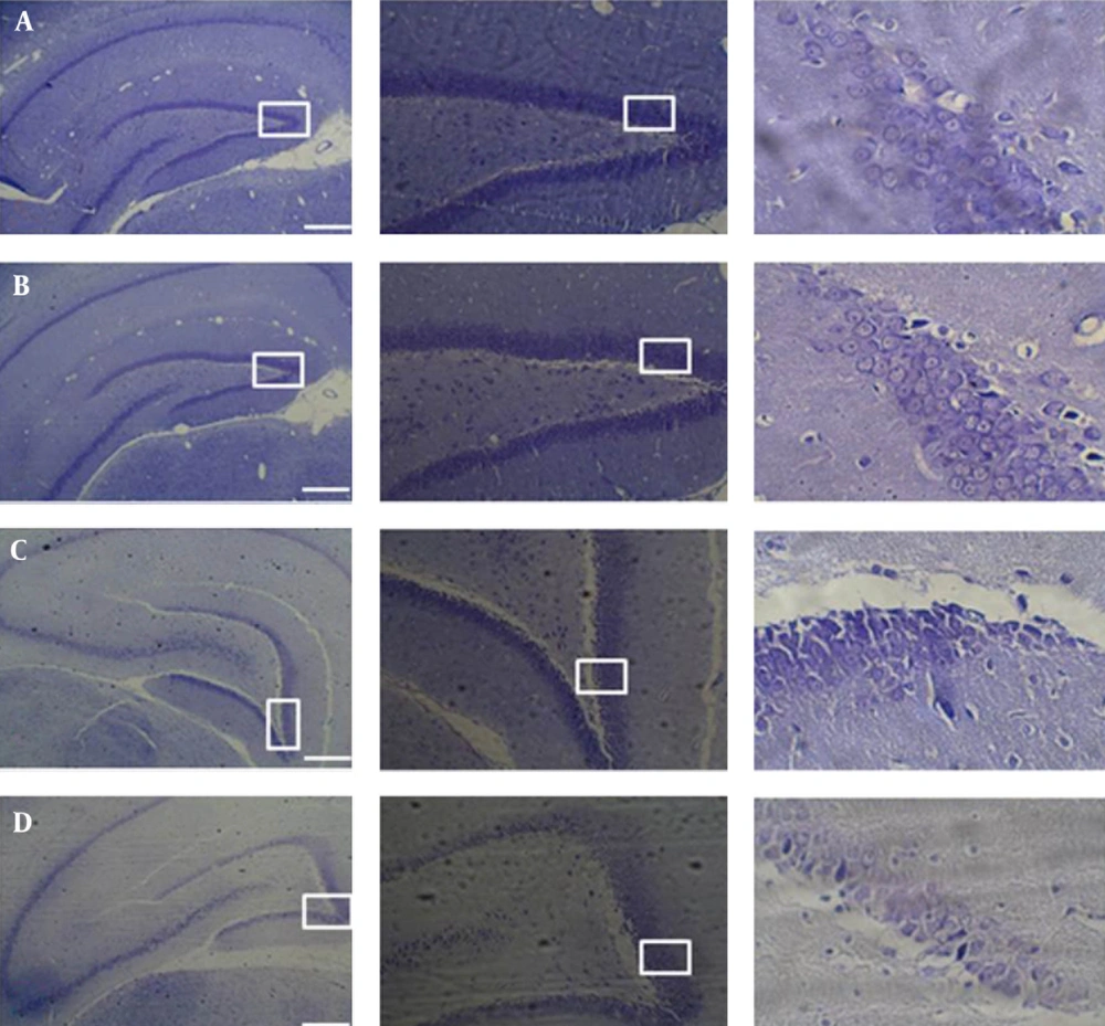 Nissl Staining of the DG Area for Control and Trial Groups Significant difference in cell number was seen. A, (control M L/D); B, (control F L/D); C, (F/TLD); D, (M/TLD).