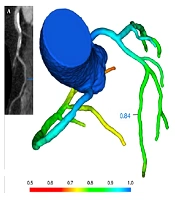 Iranian Journal of Radiology