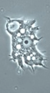 Molecular Identification and Genotyping of <i>Acanthamoeba</i> Isolated from Environmental Sources in Kashan, Central Iran