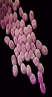 Risk Factors for Resistance and Mortality in Patients with Extensively Resistant <i>Acinetobacter</i> Bacteremia in Taleghani Hospital in Tehran, Iran