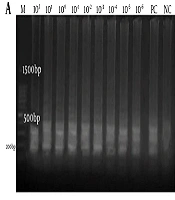 Jundishapur J Microbiol