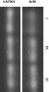 Effect of Endurance Training on Cerebellar Gene Expression of the ADP-Ribosylation Factor 6 in Rats with Diabetic Peripheral Neuropathy