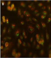 Jentashapir J Cell Mol Biol
